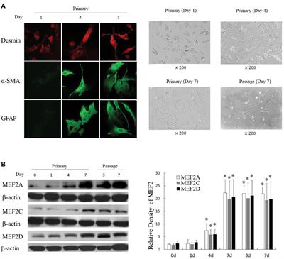 Salvianolic Acid B Inhibits Activation of Human Primary Hepatic Stellate Cells Through Downregulation of the Myocyte Enhancer Factor 2 Signaling Pathway